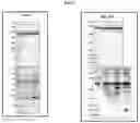 Fig. 63 - CANCER BIOMARKERS AND METHODS OF USE