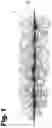 Fig. 02 - BULKY YARN