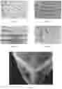 Fig. 04 - NONWOVEN NATURAL SILK FABRIC AND METHOD FOR PRODUCING SAME