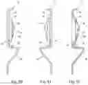 Fig. 32 - Ledger connector