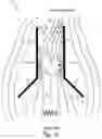 Fig. 04 - Electric power system for converting wind energy into electric energy and building with system