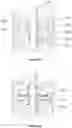 Fig. 08 - High viscosity pumping system and method of using same