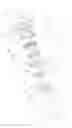 Fig. 05 - GEARLESS DIFFERENTIAL