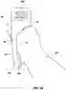 Fig. 15 - Brace apparatus for stabilizing a firearm