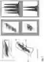 Fig. 02 - METHODS AND COMPOSITIONS FOR DETERMINING THE PRESENCE OR ABSENCE OF DNA ABERRATIONS