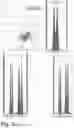 Fig. 13 - METHODS AND COMPOSITIONS FOR DETERMINING THE PRESENCE OR ABSENCE OF DNA ABERRATIONS