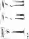 Fig. 30 - METHODS AND COMPOSITIONS FOR DETERMINING THE PRESENCE OR ABSENCE OF DNA ABERRATIONS