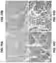 Fig. 17 - Soluble B7-H1