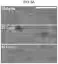 Fig. 09 - LENS FOR MEDICAL DEVICE AND MANUFACTURING METHOD THEREOF