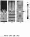 Fig. 35 - Microsphere based patterning of metal optic/plasmonic sensors including fiber based sensors