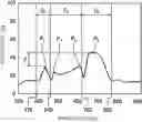 Fig. 01 - Projection image-displaying member, windshield glass, and head-up display system