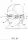 Fig. 13 - Sensor fusion for electromagnetic tracking