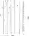 Fig. 09 - PUPIL DEPENDENT DIFFRACTIVE LENS FOR NEAR, INTERMEDIATE, AND FAR VISION