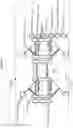 Fig. 04 - Recharging for autonomous in-pipe vehicles