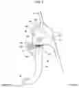 Fig. 03 - Pedal apparatus for driver protection