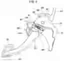 Fig. 04 - Pedal apparatus for driver protection