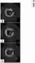 Fig. 07 - Assessment of arterial calcifications
