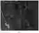 Fig. 03 - Method for thinning and connection in linear object extraction from an image