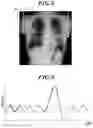 Fig. 07 - DYNAMIC IMAGE ANALYSIS APPARATUS, DYNAMIC IMAGE ANALYSIS SYSTEM AND STORAGE MEDIUM