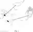 Fig. 04 - Method for controlling a device, in particular, a prosthetic hand or a robotic arm