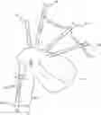 Fig. 01 - ELECTRIC BAGPIPE AND ELECTRIC BAGPIPE COMPONENTS
