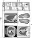 Fig. 04 - Medical information processing apparatus and medical information processing method