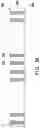 Fig. 13 - Integrated antenna package structure and manufacturing method thereof