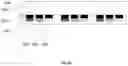 Fig. 45 - Micro device integration into system substrate