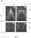 Fig. 08 - Monolithically integrated InGaN/GaN quantum nanowire devices