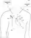 Fig. 01 - Recharge of implanted medical devices