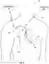 Fig. 03 - Recharge of implanted medical devices