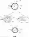 Fig. 12 - Recharge of implanted medical devices