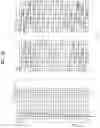 Fig. 28 - Broadcasting signal transmission device, broadcasting signal reception device, broadcasting signal transmission method, and broadcasting signal reception method