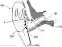 Fig. 01 - Multi-mic earphone design and assembly