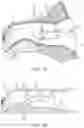 Fig. 02 - Hearing devices with eye movement detection