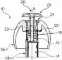 Fig. 01 - Reduced feedback in valve-ric assembly