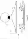 Fig. 06 - Spacer for surface mountable electronic components