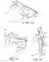 Fig. 07 - Apparatus to assist a user with holding a mobile device