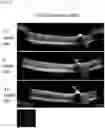 Fig. 02 - METHOD FOR OBTAINING RETINAL DEGENERATION (rd) MODEL MOUSE HAVING LOW RISK OF CAUSING RETINAL DETACHMENT
