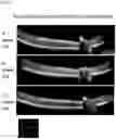 Fig. 03 - METHOD FOR OBTAINING RETINAL DEGENERATION (rd) MODEL MOUSE HAVING LOW RISK OF CAUSING RETINAL DETACHMENT