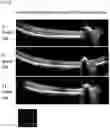 Fig. 04 - METHOD FOR OBTAINING RETINAL DEGENERATION (rd) MODEL MOUSE HAVING LOW RISK OF CAUSING RETINAL DETACHMENT