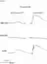 Fig. 08 - METHOD FOR OBTAINING RETINAL DEGENERATION (rd) MODEL MOUSE HAVING LOW RISK OF CAUSING RETINAL DETACHMENT