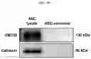 Fig. 05 - Method for lyophilizing exosome