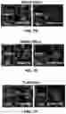 Fig. 14 - COMPOSITIONS FOR ORGAN GRAFT PRESERVATION AND METHODS OF USE