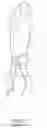 Fig. 02 - Gown-glove interface reinforcement accessory