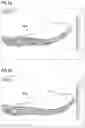 Fig. 06 - Sole for a shoe