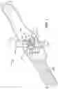 Fig. 02 - Method and apparatus for transporting a wheeled case
