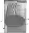 Fig. 01 - Convertible bed bumper apparatus