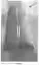Fig. 02 - Convertible bed bumper apparatus