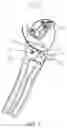 Fig. 05 - NUT CRACKER